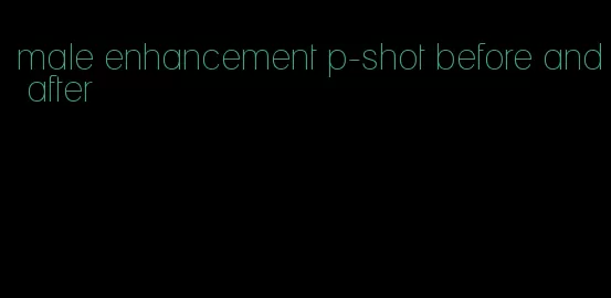 male enhancement p-shot before and after