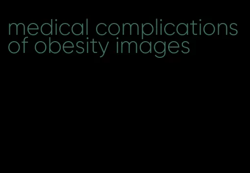 medical complications of obesity images