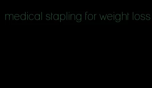 medical stapling for weight loss