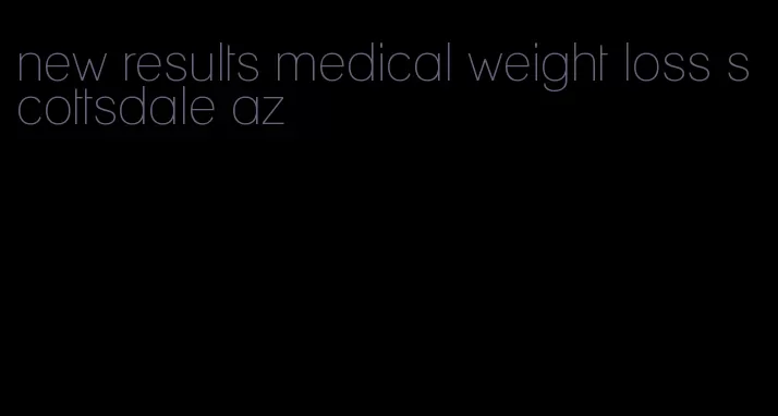 new results medical weight loss scottsdale az