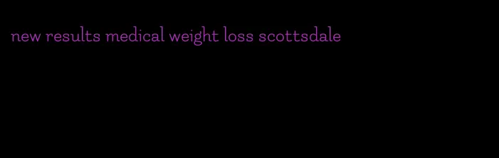 new results medical weight loss scottsdale