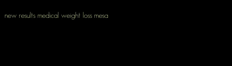 new results medical weight loss mesa