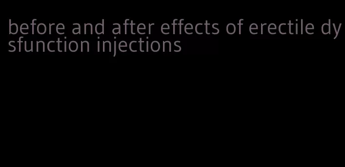 before and after effects of erectile dysfunction injections