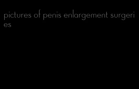 pictures of penis enlargement surgeries