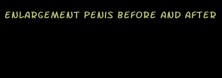 enlargement penis before and after