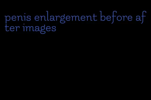 penis enlargement before after images