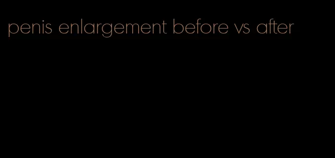 penis enlargement before vs after