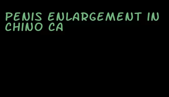 penis enlargement in chino ca