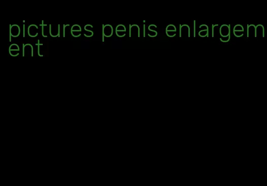 pictures penis enlargement