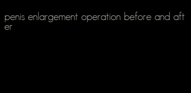 penis enlargement operation before and after