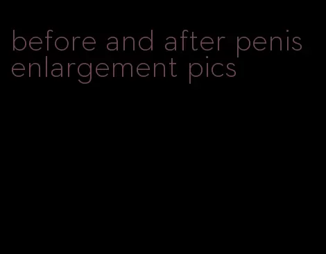 before and after penis enlargement pics