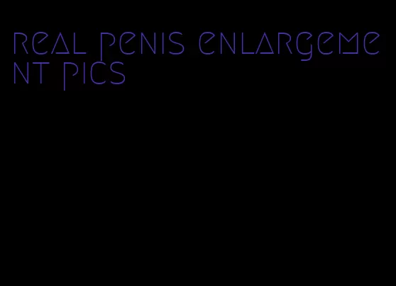 real penis enlargement pics