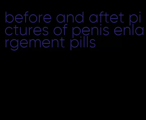 before and aftet pictures of penis enlargement pills