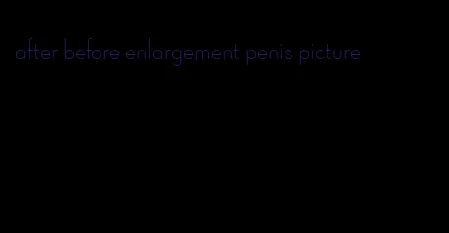 after before enlargement penis picture