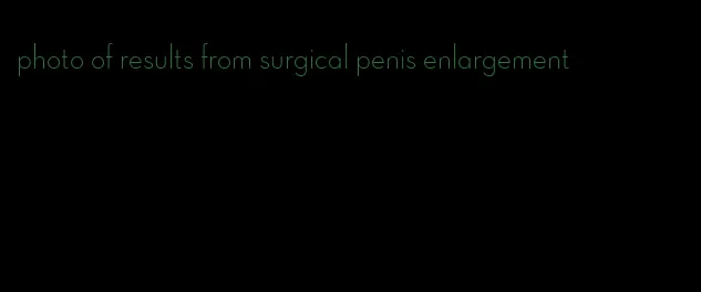 photo of results from surgical penis enlargement