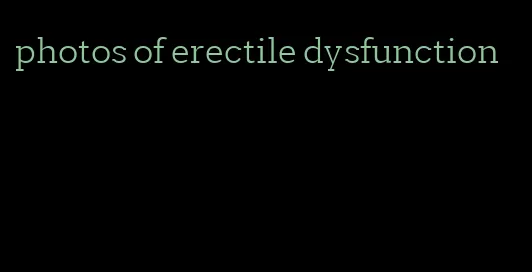 photos of erectile dysfunction