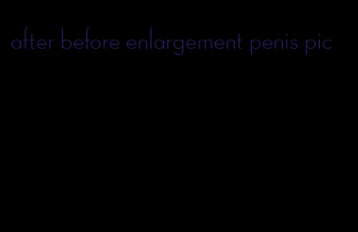 after before enlargement penis pic