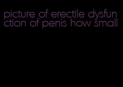 picture of erectile dysfunction of penis how small