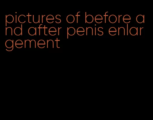 pictures of before and after penis enlargement