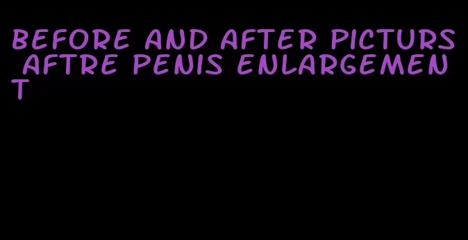 before and after picturs aftre penis enlargement