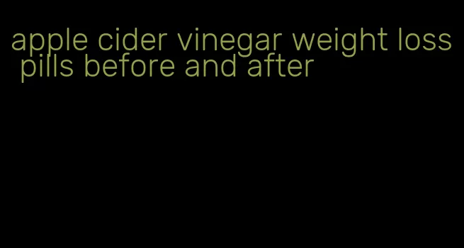 apple cider vinegar weight loss pills before and after