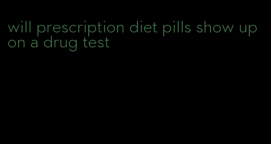 will prescription diet pills show up on a drug test