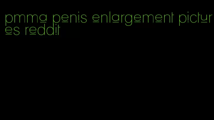 pmma penis enlargement pictures reddit