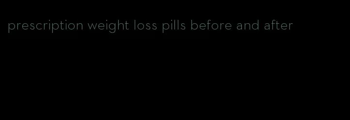 prescription weight loss pills before and after