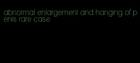 abnormal enlargement and hanging of penis rare case