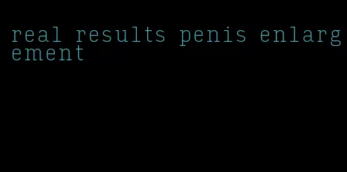 real results penis enlargement