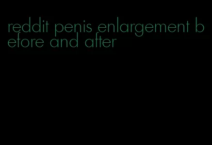 reddit penis enlargement before and after