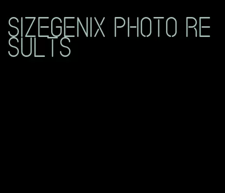 sizegenix photo results