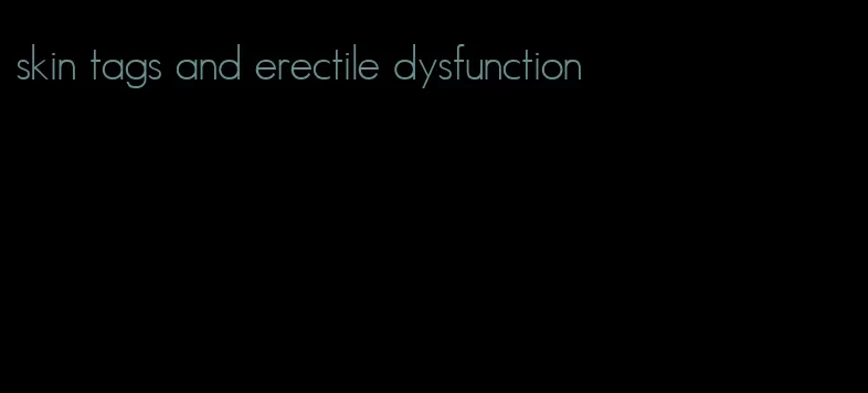 skin tags and erectile dysfunction