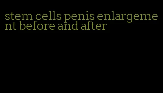 stem cells penis enlargement before and after