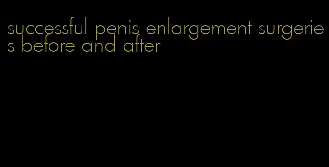 successful penis enlargement surgeries before and after