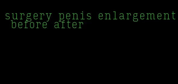 surgery penis enlargement before after