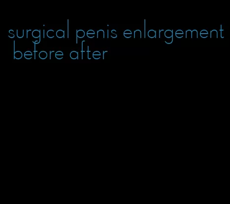 surgical penis enlargement before after