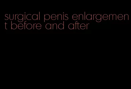 surgical penis enlargement before and after