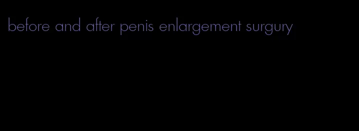 before and after penis enlargement surgury