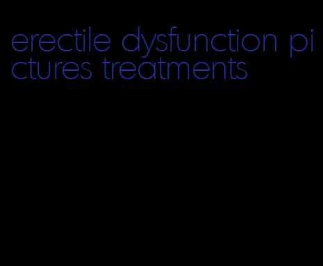 erectile dysfunction pictures treatments